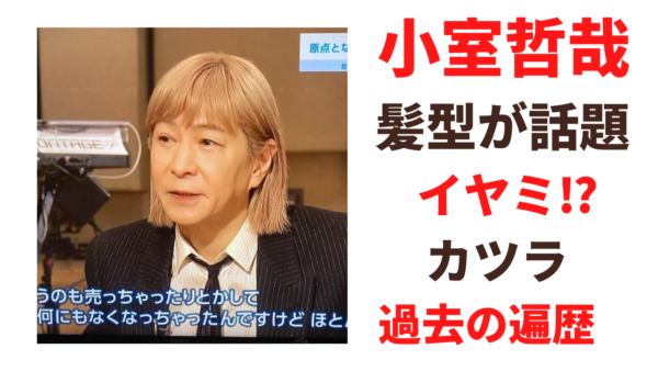 【画像】小室哲哉の髪型が話題！実はハゲでカツラ疑惑についても！